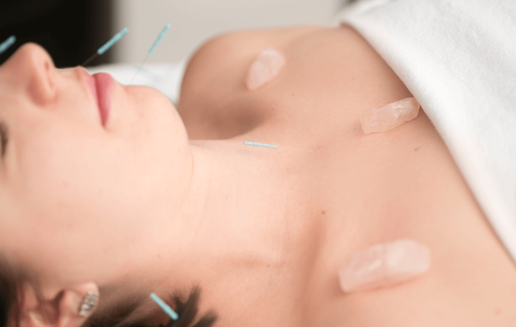 esoteric-acupuncture-airdrie